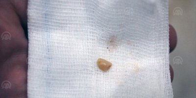 GRİP TEŞHİSİYLE HASTANEYE GÖTÜRÜLDÜ.. BAKIN RAHATSIZLIĞI NEYMİŞ?