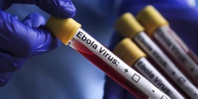Dünya Kupası öncesi ebola paniği