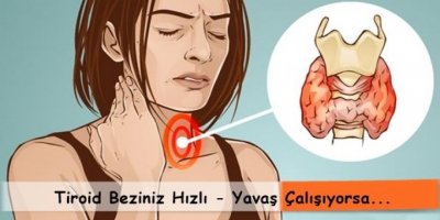 İŞTE TİROİD TEDAVİSİNDE BİLİNMEYENLER