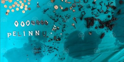 İZMİR'DE BİR HASTANIN MİDESİNDEN BUNLAR ÇIKTI..TAM 200 PARÇA