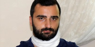 HASTA TARAFINDAN BOĞAZI KESİLEN DOKTOR AÇIKLAMA YAPTI