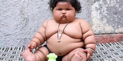 TÜRKİYE'NİN İLK ÇOCUK OBEZİTE MERKEZİ İZMİR'DE AÇILDI